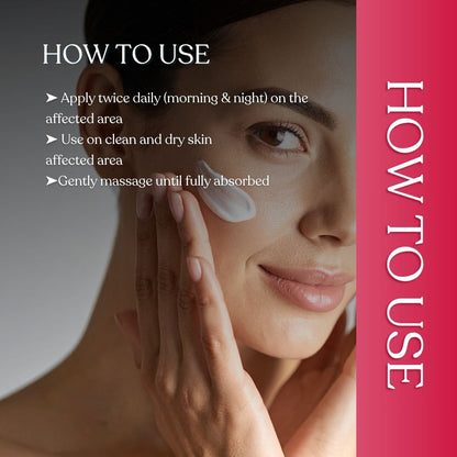 Hyper Pigmentation Cream (100 gm)