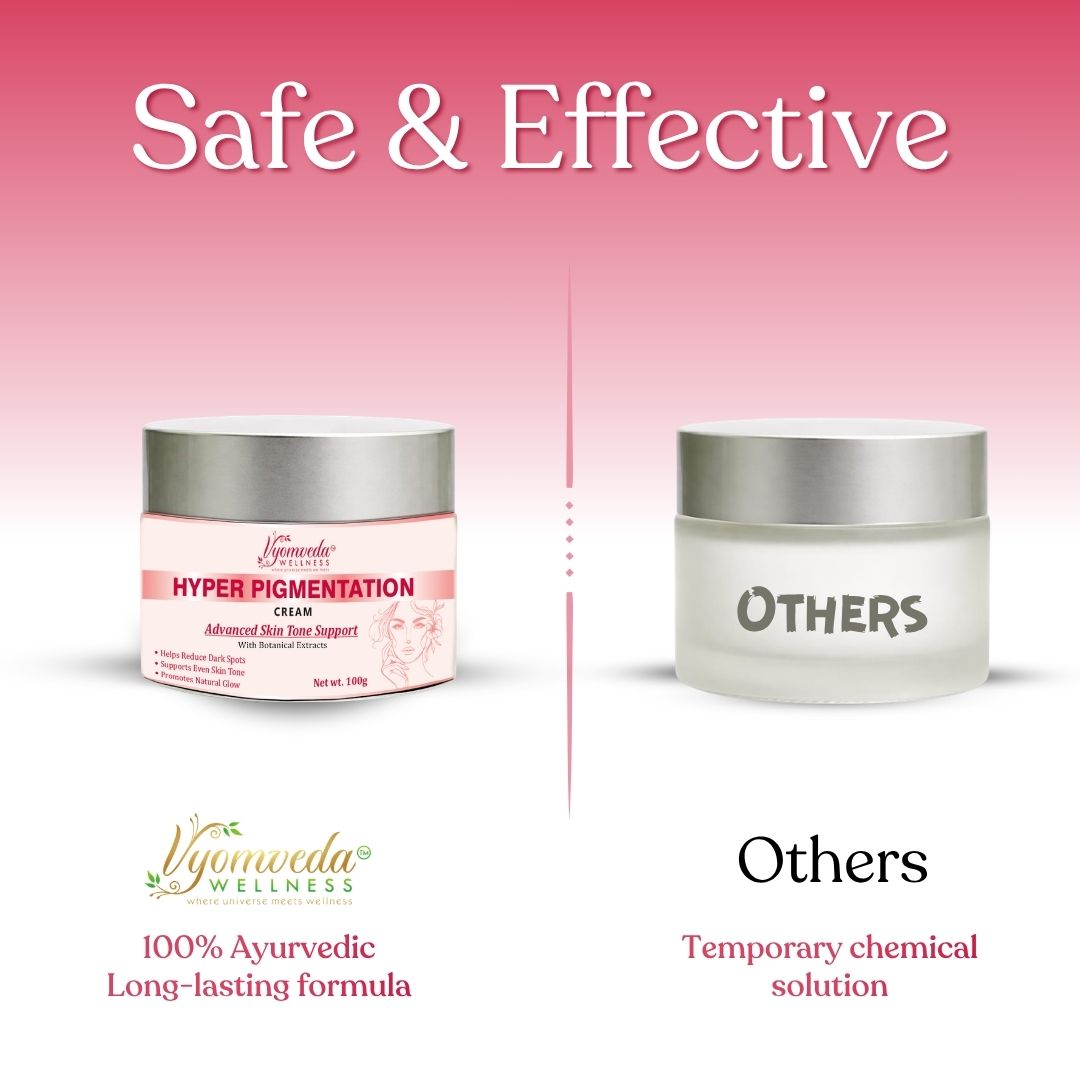 Hyper Pigmentation Cream (100 gm)