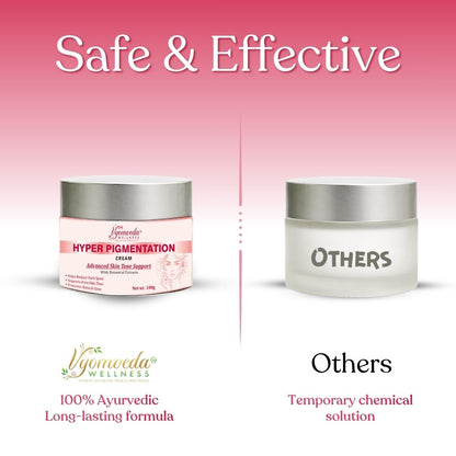 Hyper Pigmentation Cream (100 gm)